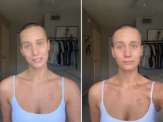 Ho trovato un nodulo sulla clavicola – La diagnosi mi ha sconvolto la vita – Newsweek