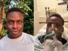 L’uomo, 24 anni, pensava che i suoi dolori al petto fossero dovuti allo stress lavorativo, poi ha ricevuto la diagnosi di shock