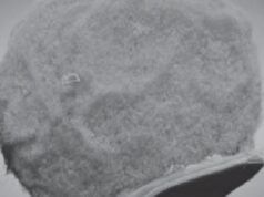 I minuscoli frammenti viaggiano sulle cellule immunitarie fino al sito dell’infiammazione