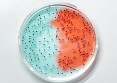 CARPHA celebra la settimana globale di sensibilizzazione sulla resistenza antimicrobica (AMR): evidenzia i progressi regionali nella lotta contro la resistenza antimicrobica