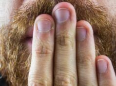 L’ex presidente ha subito un intervento chirurgico a causa del singhiozzo