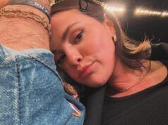 Selena Gomez risponde ai commenti sui baffi durante la diagnosi di melasma