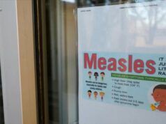 L’aumento dell’esposizione al morbillo solleva interrogativi sugli integratori e sulla cura dei bambini con un sistema immunitario indebolito