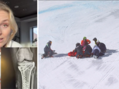 Lindsey Vonn dice che un intervento chirurgico l’ha salvata dall’amputazione della gamba sinistra