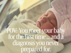 La mamma aveva scansioni perfette, impreparata alla diagnosi del medico pochi istanti dopo la nascita