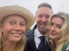 Apple Martin ha rivelato la procedura cosmetica che aveva eseguito