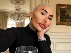 Jordan James Park, il re delle labbra pasticciato, muore a 34 anni