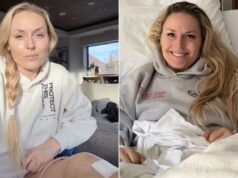 Lindsay Vonn ha rivelato che la sua gamba è stata quasi amputata dopo un incidente olimpico