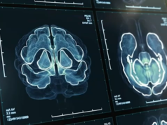 Lo studente di infermieristica della Duke si unisce allo sforzo nazionale per migliorare la diagnosi precoce dell’Alzheimer