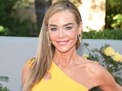 Foto del lifting prima e dopo di Denise Richards