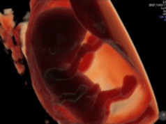 Alimenti comuni legati alla diminuzione della fertilità maschile e alla crescita lenta del feto