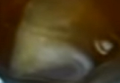 Un consumatore antiguano trova una strana sostanza nel contenitore del succo